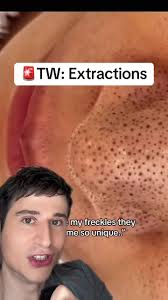 #duet with @Luelle Those are NOT freckles!!! #dermreacts #skincare  #dermatologist #reaction #reactionvideo #dermangelo #pimplepopping