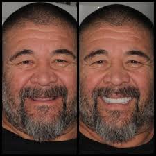 Rose Dental Studio in Mexico