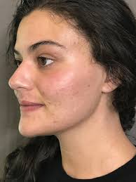 Tamara's Skin Care Clinic Services