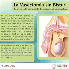 Recuerda que la vasectomia sin bisturí es un método anticonceptivo con una efectividad mayor al 99%. Secretaria De Salud On Twitter La Vasectomia Sin Bisturi Es Un Metodo Permanente De Anticoncepcion Masculina Te La Presentamos Agarraturbo Https T Co I3idzdp3rg Twitter