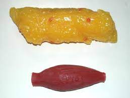 5 Lbs Of Muscle Vs 5 Lbs Of Fat