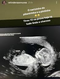 E pra ver o vídeo completo, vai lá no meu ninguém quer você naquele estágio triste de novo faça isso pelo seu próprio bem e pelas pessoas. Whindersson Compartilha Ultrassom Do Filho Tirou 10