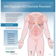 welch allyn ecg placement wall chart 71300 000