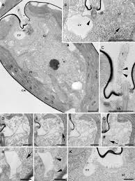Contractile vacuole function in animal cell. Structure Of The Contractile Vacuole In S Dubia As Revealed By Download Scientific Diagram