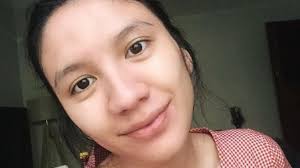 Semakin tua usia ibu hamil maka semakin banyak resiko terkena flek hitam. Kenali 6 Masalah Kulit Pada Bumil Salah Satunya Dialami Oleh Acha Sinaga