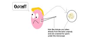 Can A Sterile Man Get A Woman Pregnant ? Learn The Truth Today