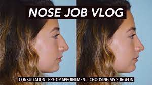 Maybe you would like to learn more about one of these? Rhinoplasty Vlog Finding A Surgeon Nose Job Consultation Pre Op Appointment Youtube