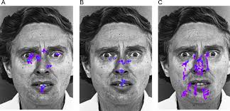 Recognition of facial emotions and identity in patients with mesial  temporal lobe and idiopathic generalized epilepsy: An eye-tracking study