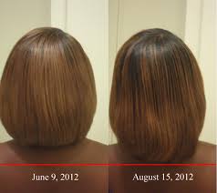 Some evidence suggests that taking 5000mcg of biotin every day for up to 3 months may help you have thicker and longer hair. Biotin Checkin After The First 60 Days Savvy Hair Studio101