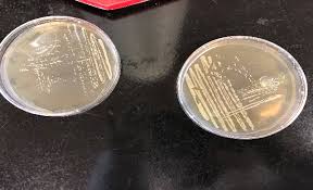 Ivanovii colonies from those of other listeria spp. Isolating Listeria Monocytogenes In Food Sample