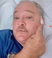 MD Anderson Cancer Center Melanoma Survey for Young Adults