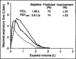 Used to measure lung function in people with asthma, pef can because asthma is a respiratory condition in which the airways in the lungs are narrowed and inflamed, being able to expel more air—meaning that. Home Peak Expiratory Flow Rate Monitoring In Patients With Asthma Mayo Clinic Proceedings