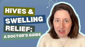 Managing Chronic Hives? More than just a rash! #hives #chronichives  #chronicurticaria #allergy