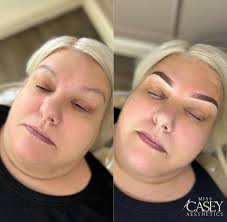 Miss Casey Aesthetics