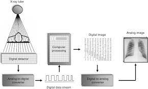 Experimental results presented confirm the necessity of. Digital Radiography An Overview Springerlink