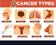 Cancer Types – Chandigarh Cancer & Diagnostic Center