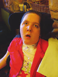 Zeda Pingel before and after HPV vaccination. She received the quadrivalent  human papillomavirus vaccine, also known as Gardasil