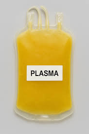 Image result for Plasma Transfusion