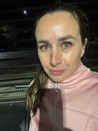 Before and After of AshLin Esthetics, LLC working her magic