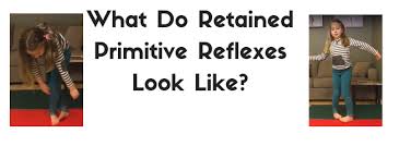 what do retained primitive reflexes look like