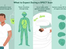 Spect Scan Uses Side Effects Procedure Results