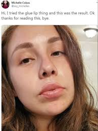 Algunas mujeres se están pegando los labios para tenerlos como Kylie Jenner
