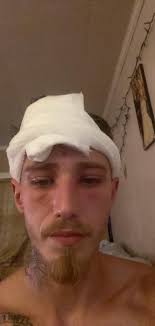 Chainsaw Safety and Accident Prevention