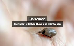 Wir erklären, wann ein zeckenbiss gefährlich sein kann und wann man einen arzt aufsuchen sollte. Borreliose Symptome Behandlung Spatfolgen Praktischarzt