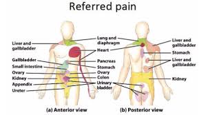 Normally, this bursa has very little fluid in it but if it becomes irritated it can fill with fluid, become painful and also irritate the surrounding rotator cuff tendons. Referred Pain The Islander