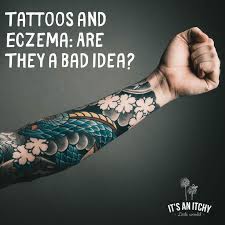 Tattoo artists state that there are a number of color dyes that may cause allergic reactions. Tattoos And Eczema Are They A Bad Idea