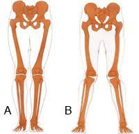 Pin On Toning Exercises