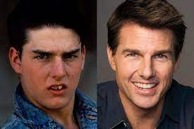 Sinopsis vanilla sky, ketika tom cruise terjebak antara kenyataan dan mimpi. Diese 25 Promis Haben Sich Zum Gluck Die Zahne Richten Lassen Celebrityred