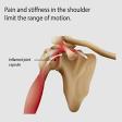 Frozen Shoulder product image