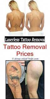 Pin On Tattoo Removal