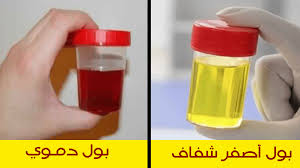 لماذا البول لونه احمر افضل اجابة