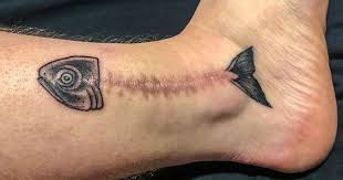 Using A Scar As Part Of A Tattoo What A Creative Idea Www Otziapp Com Tatuaje En Cicatriz Tatuajes De Anzuelo Disenos De Tatuaje Para Parejas
