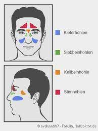 Nasennebenhohlenentzundung Behandlung Und Symptome Netdoktor