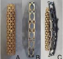A “home made” titanium telescopic mesh for an emergent ...