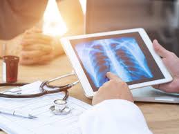 When dustin diamond died of lung cancer at age 44, it was shock—because he was so young, but also because it happened so fast. Early Signs Of Lung Cancer Here Are 5 Early Signs Symptoms To Detect Lung Cancer How To Detect Lung Cancer In Early Stage