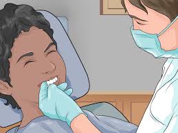 Correcting an overbite with braces. How To Prepare For Getting Braces Removed 12 Steps