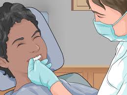 To remove braces from teeth, you need special dental tools and should consult a specialis. How To Prepare For Getting Braces Removed 12 Steps