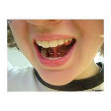 Illustrated Guide To Tongue Piercings Frenulum Piercing Piercing Web Piercing