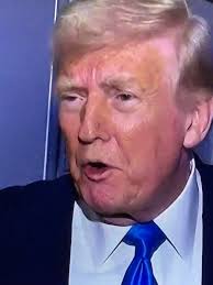 Trump's Unhealthy Appearance