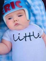 Craniosynostosis Awareness