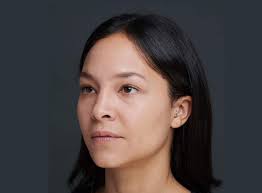 ART FILLER: Wrinkle filler & Hyaluronic Acid Dermal Fillers