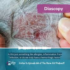 Image result for Diascopy