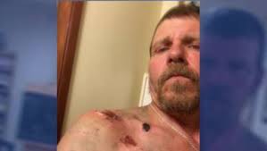 Man survives attack by mother grizzly bear