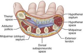 Hand Infections Musculoskeletal Key