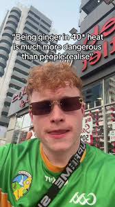How ive not not burnt yet ive no idea #ginger #irish