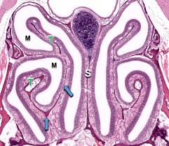 The maxillary sinus is a cavity which freely communicates with the nasal cavity, and is known as the maxillary recess. Air Conduction Nasal Cavity Paranasal Sinuses And Vomeronasal Organ Veterinary Histology